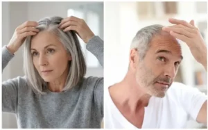 גבר ואישה הסובלים מנשירת שיער והתקרחות בודקים את מצב השיער